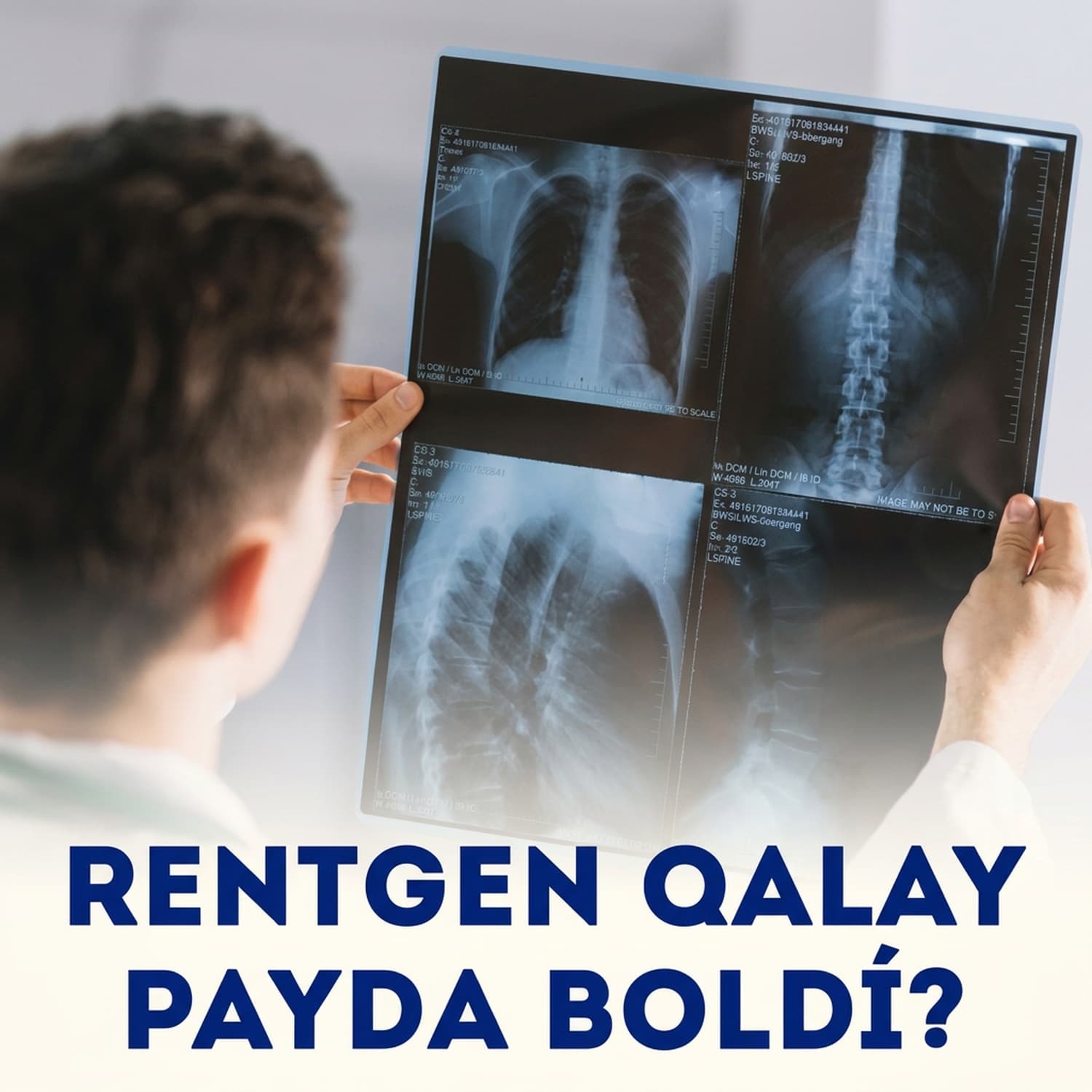 Rentgen: Medicinadaǵı kútilmegen oylap tabılıw | Aydın